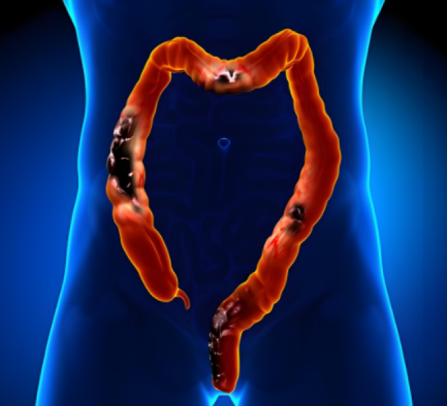 百心科技肠道健康产品选购指南：如何选对适合自己的肠道调理方案